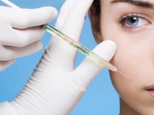 Injection d'acide hyaluraunique