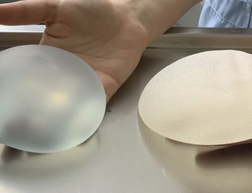 Prohibidos en Francia los implantes mamarios de macrotextura y poliuretano