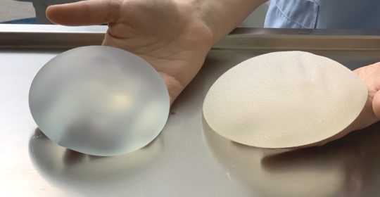 Les implants mammaire macrotexturés et polyurethane interdits en France