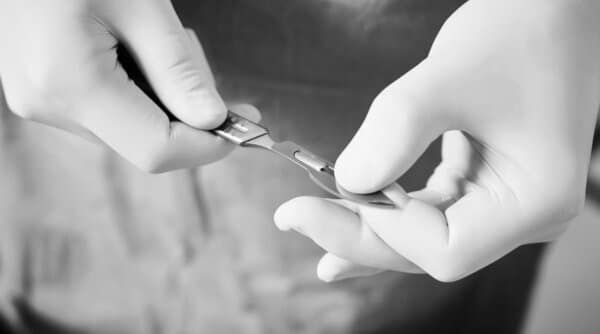 scalpel Bichectomie – Ablation des boules de Bichat scalpel Bichectomie - Ablation des boules de Bichat