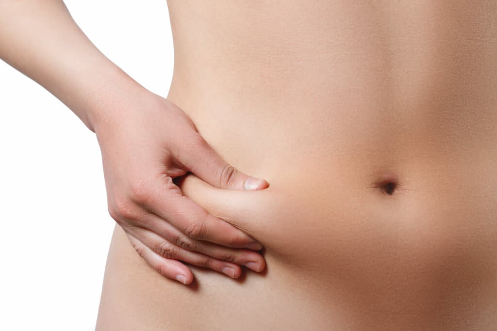 Female Liposuction Belly