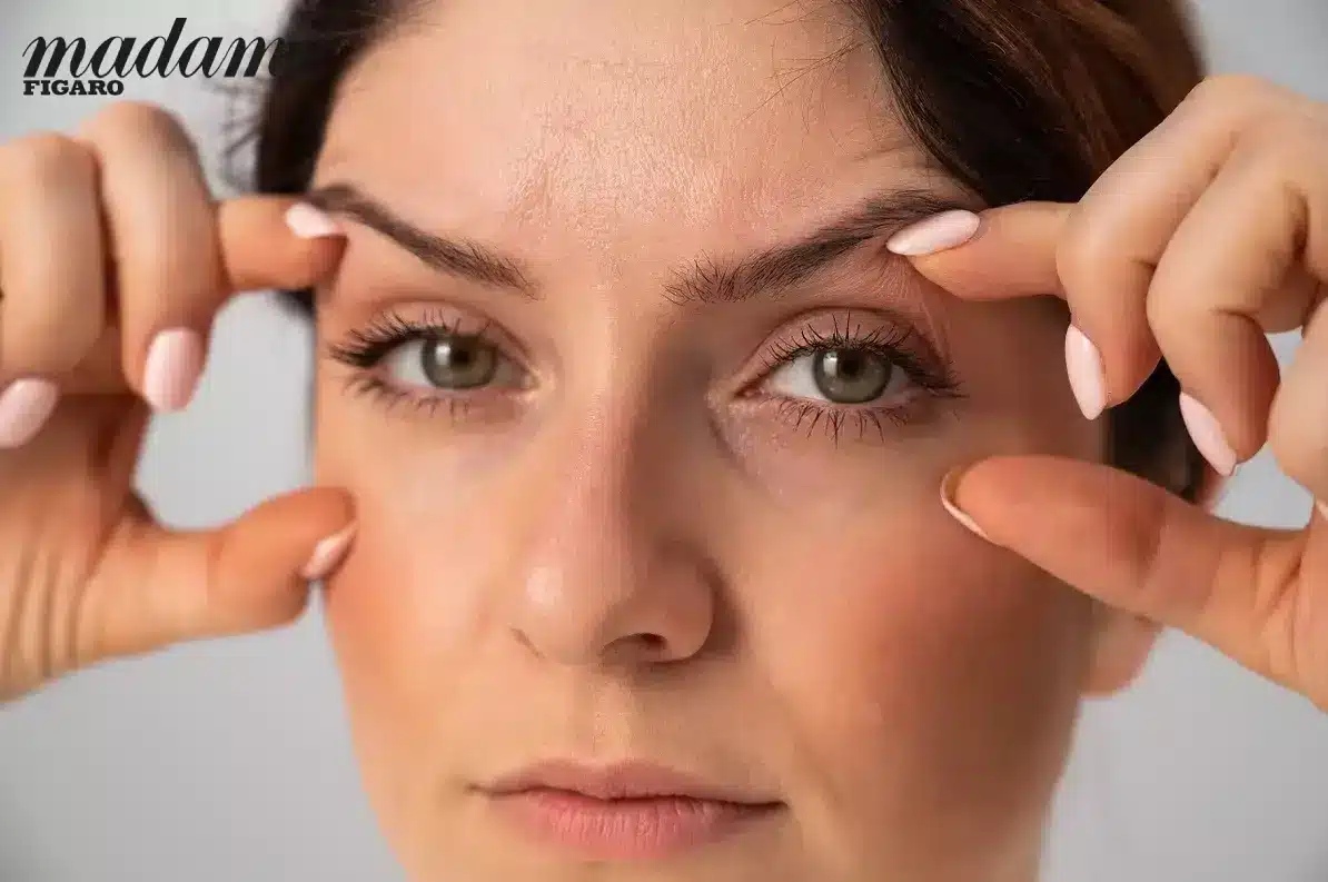 chirurgie des paupières - blépharoplastie - Interview Figaro madame
