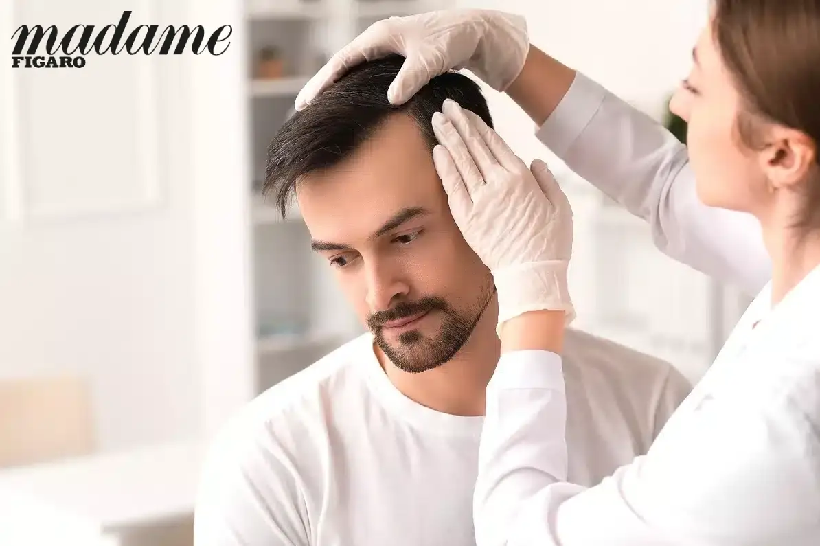 Greffe de cheveux - interview Madame figaro