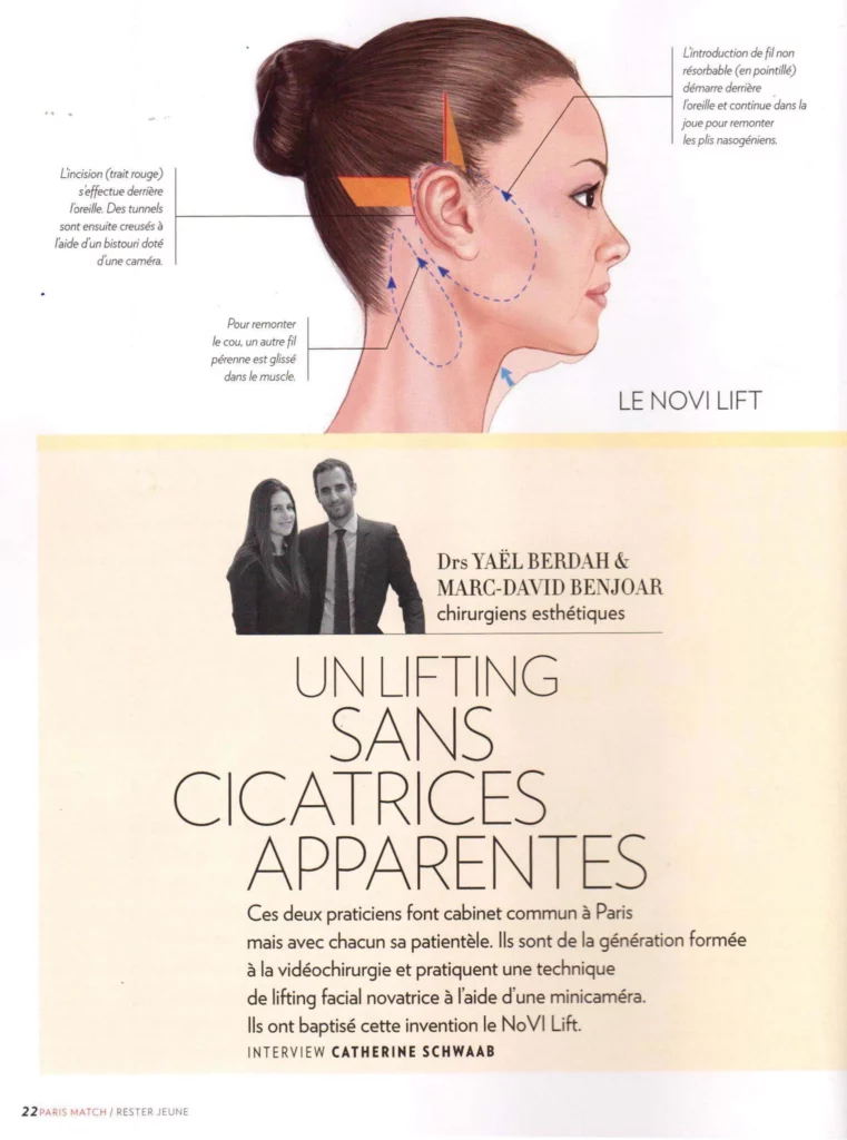 Novi Lift dans Paris Match