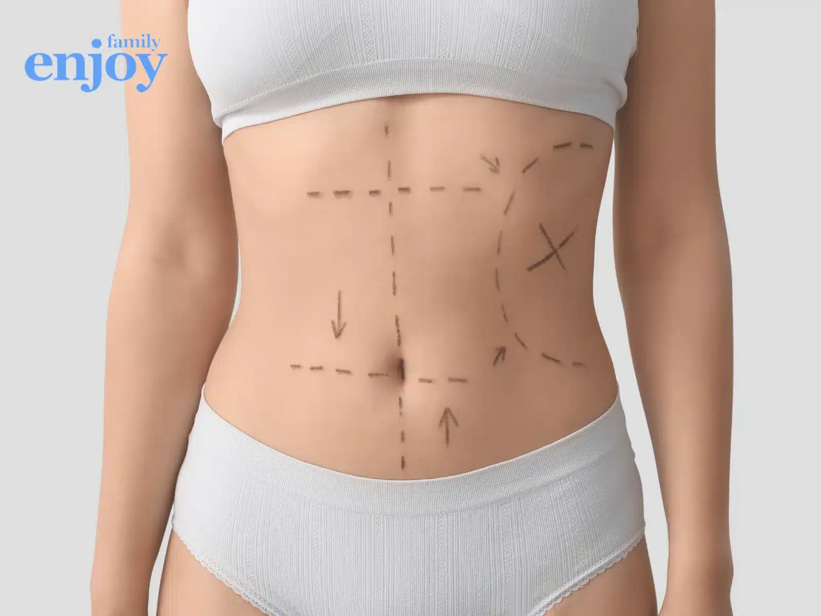 operation mommy makeover