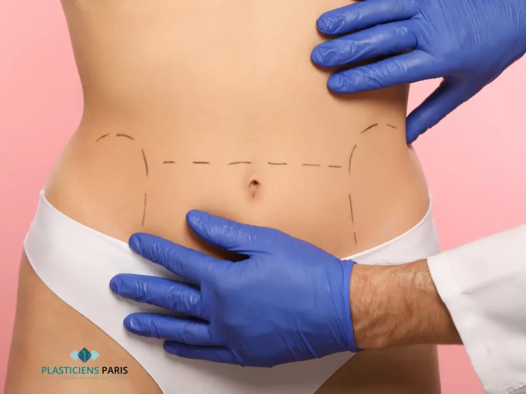 Combien de taille perd-on après une liposuccion ?