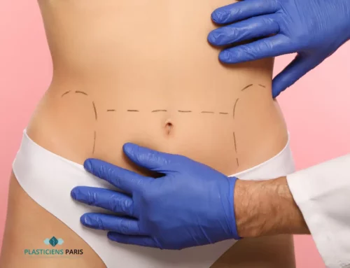 Quelles sont les conditions de prise en charge et remboursement d’une abdominoplastie ?