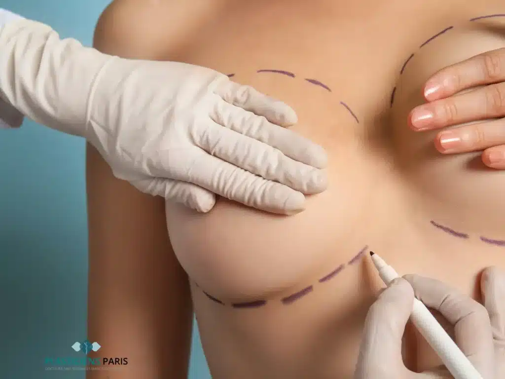 remboursement d'une augmentation mammaire Comment perdre de la poitrine en 1 semaine
