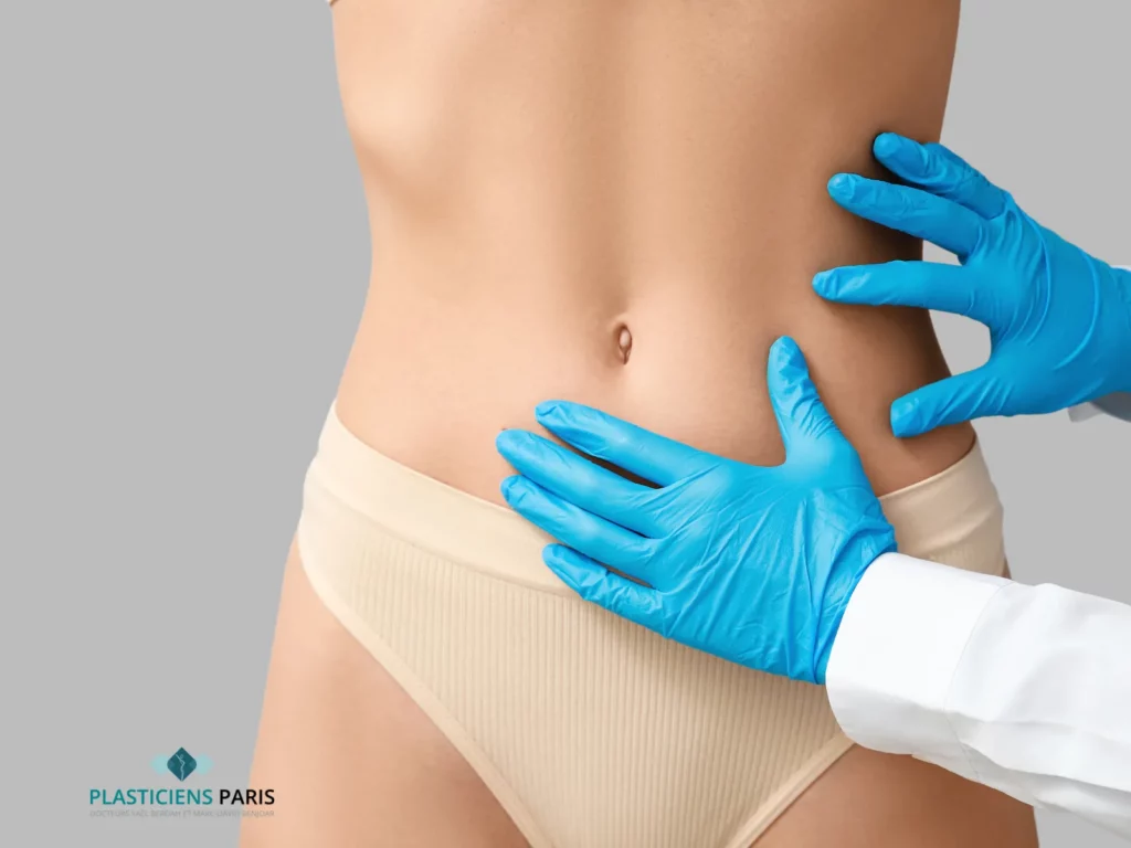 liposuccion du ventre